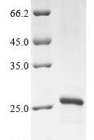 Dog Prorelaxin (RLN) Recombinant Protein - BioCrest Sci