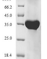 Human HLA class I histocompatibility antigen, alpha chain G (HLAG) Recombinant Protein - BioCrest Sci