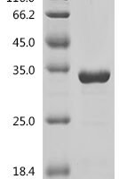 Human Heterogeneous nuclear ribonucleoproteins A2/B1 (HNRNPA2B1), partial Recombinant Protein, C-His - BioCrest Sci