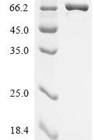 Escherichia coli Aspartate--tRNA ligase (aspS) Recombinant Protein - BioCrest Sci