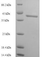 Human Dynamin-1 (DNM1), partial Recombinant Protein, N-His-SUMO - BioCrest Sci