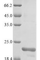 Human Monocarboxylate transporter 5 (SLC16A4), partial Recombinant Protein - BioCrest Sci