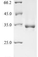 Bovine Insulin-like growth factor I (IGF1) Recombinant Protein, N-hFc - BioCrest Sci
