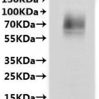 Macaca mulatta Solute carrier family 10 member 1 (SLC10A1)-VLPs Recombinant Protein - BioCrest Sci
