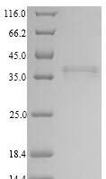 Human Collectin-11 (COLEC11) Recombinant Protein - BioCrest Sci