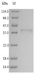 Human Collectin-11 (COLEC11) Recombinant Protein, Homo sapiens (Human), Mammalian cell, N-terminal 10xHis-tagged and C-terminal Myc-tagged, 30.1 kDa, purity >≥ 90% as determined by SDS-PAGE.
