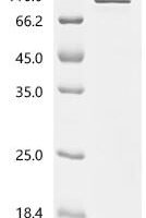 Human Zinc finger protein 746 (ZNF746) Recombinant Protein - BioCrest Sci