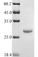 Human Platelet-derived growth factor subunit B (PDGFB) Recombinant Protein, N-His-SUMO - BioCrest Sci