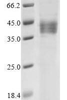 Human Receptor for retinol uptake STRA6 (STRA6), partial Recombinant Protein - BioCrest Sci