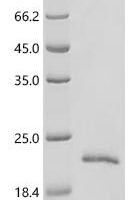 Diaphorina citri General odorant-binding protein 3 (LOC103507602) Recombinant Protein - BioCrest Sci