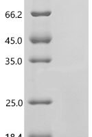 Human Transmembrane protein 45B (TMEM45B), partial Recombinant Protein - BioCrest Sci