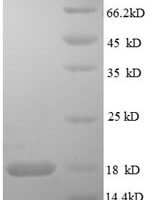Human Tumor necrosis factor receptor superfamily member 19L protein (RELT), partial Recombinant Protein - BioCrest Sci
