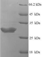 Human Neurotensin/neuromedin N (NTS), partial Recombinant Protein - BioCrest Sci