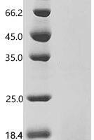 Human Coagulation factor X (F10), partial Recombinant Protein, N-His, aa 86–165, Yeast - BioCrest Sci