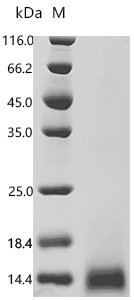 Human Coagulation factor X (F10), partial Recombinant Protein, N-His, aa 86–165, Yeast, Homo sapiens (Human), Yeast, N-terminal 6xHis-tagged, 10.2 kDa, purity >≥ 90% as determined by SDS-PAGE.