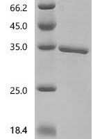 Human Glucocorticoid receptor (NR3C1), partial Recombinant Protein, C-His - BioCrest Sci