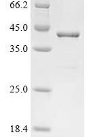 Vaccinia virus Pseudokinase OPG198 (B12) Recombinant Protein - BioCrest Sci