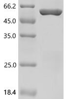 Mouse Talin-2 (Tln2), partial Recombinant Protein, C-His - BioCrest Sci