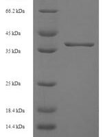 Human Ankyrin repeat and SOCS box protein 6 (ASB6) Recombinant Protein - BioCrest Sci