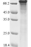 Human Forkhead box protein N1 (FOXN1) Recombinant Protein - BioCrest Sci