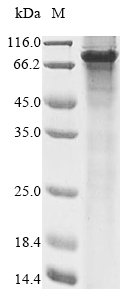 Human Forkhead box protein N1 (FOXN1) Recombinant Protein, Homo sapiens (Human), E.coli, N-terminal 10xHis-tagged and C-terminal Myc-tagged, 73.9 kDa, purity >≥ 85% as determined by SDS-PAGE.