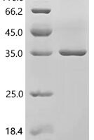 Human DNA mismatch repair protein Msh3 (MSH3), partial Recombinant Protein - BioCrest Sci