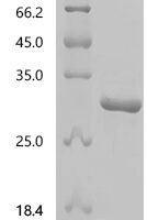 Neisseria gonorrhoeae Ribonuclease HII (rnhB) Recombinant Protein, N-His - BioCrest Sci