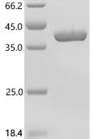 Human Nicotinate phosphoribosyltransferase (NAPRT), partial Recombinant Protein, C-His - BioCrest Sci