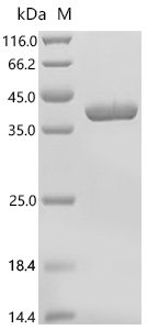 Human Nicotinate phosphoribosyltransferase (NAPRT), partial Recombinant Protein, C-His, Homo sapiens (Human), E.coli, C-terminal 6xHis-tagged, 40.1 kDa, purity >≥ 95% as determined by SDS-PAGE.