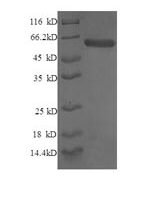 Human Syntaxin-6 (STX6), partial Recombinant Protein - BioCrest Sci