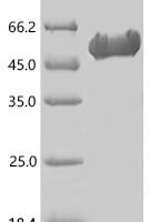 Human Proprotein convertase subtilisin/kexin type 7 (PCSK7), partial Recombinant Protein - BioCrest Sci