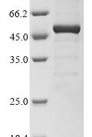 Plasmodium ovale Tryptophan-rich protein (PowCR01_000150100), partial Recombinant Protein - BioCrest Sci