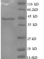 Human Interleukin-10 (IL10) Recombinant Protein, N-GST - BioCrest Sci