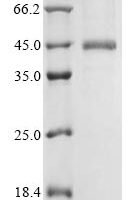 Rat Brevican core protein (Bcan), partial Recombinant Protein, C-hFc1 - BioCrest Sci