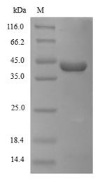 Zaire ebolavirus Pre-small/secreted glycoprotein (GP) Recombinant Protein, N-His, aa 33–364, strain Eckron-76, Yeast, Zaire ebolavirus (strain Eckron-76) (ZEBOV) (Zaire Ebola virus), Yeast, N-terminal 6xHis-tagged, 39.3 kDa, purity >≥ 90% as determined by SDS-PAGE.