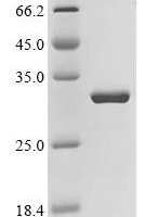 Pseudomonas putida Probable HTH-type transcriptional regulator ttgR (ttgR) Recombinant Protein - BioCrest Sci