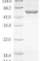 Human RING finger protein 212 (RNF212) Recombinant Protein - BioCrest Sci