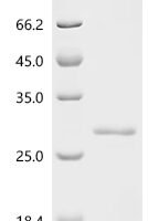 Mycobacterium tuberculosis variant africanum PE family protein PE13 Recombinant Protein - BioCrest Sci