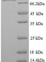 Human Phosphoenolpyruvate carboxykinase, cytosolic [GTP] (PCK1) Recombinant Protein - BioCrest Sci