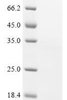Human Bromodomain-containing protein 2 (BRD2), partial Recombinant Protein, N-His - BioCrest Sci
