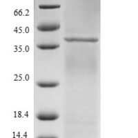 Human E3 SUMO-protein ligase RanBP2 (RANBP2), partial Recombinant Protein, N-His-B2M - BioCrest Sci
