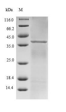Human E3 SUMO-protein ligase RanBP2 (RANBP2), partial Recombinant Protein, N-His-B2M, Homo sapiens (Human), E.coli, N-terminal 6xHis-B2M-tagged, 36.8 kDa, purity >≥ 90% as determined by SDS-PAGE.