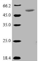 Mesomycoplasma hyopneumoniae 46 kDa surface antigen (p46) Recombinant Protein - BioCrest Sci