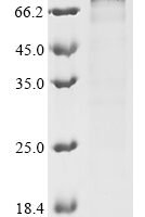 Mouse Ribosomal protein S6 kinase alpha-4 (Rps6ka4) Recombinant Protein, C-His - BioCrest Sci