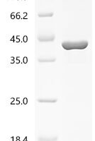 Staphylococcus aureus Gamma-hemolysin component C (hlgC) Recombinant Protein, C-His - BioCrest Sci