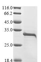Crotalus atrox Snake venom serine protease catroxase-2 Recombinant Protein, N-10His/C-Myc - BioCrest Sci