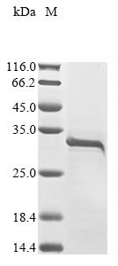 Crotalus atrox Snake venom serine protease catroxase-2 Recombinant Protein, N-10His/C-Myc, Crotalus atrox (Western diamondback rattlesnake), Baculovirus, N-terminal 10xHis-tagged and C-terminal Myc-tagged, 29.1 kDa, purity >≥ 85% as determined by SDS-PAGE.