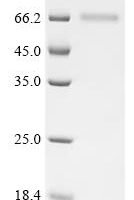 Human Protein cereblon (CRBN) Recombinant Protein, N-10His - BioCrest Sci