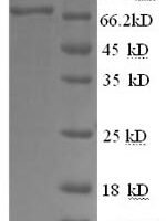Human Prostaglandin G/H synthase 2 (PTGS2), partial Recombinant Protein - BioCrest Sci