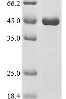 Human DNA excision repair protein ERCC-1 (ERCC1) Recombinant Protein - BioCrest Sci